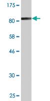 Anti-NOVA1 Mouse Monoclonal Antibody [clone: 3F7]