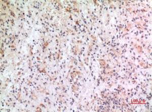 Immunohistochemical analysis of paraffin-embedded human brain using Anti-CX3CL1 Antibody