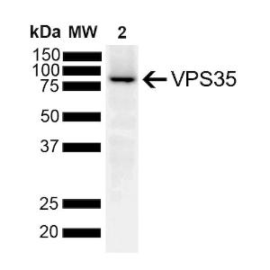 Western blot analysis showing detection of VPS35 protein using Anti-VPS35 Antibody [10A8] (A305035)