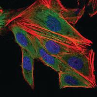 Anti-IL1B Mouse Monoclonal Antibody [clone: 3A6]