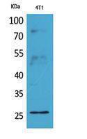 Anti-CD81 antibody