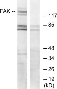 Western blot analysis of lysates from HeLa cells, treated with EGF using Anti-FAK Antibody. The right hand lane represents a negative control, where the antibody is blocked by the immunising peptide