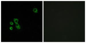 Antibody anti-TAS2R7 A99504-100 100 µg