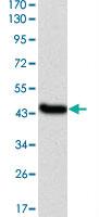 Anti-IL1B Mouse Monoclonal Antibody [clone: 3A6]