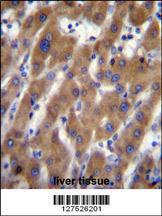 Anti-UBAP2 Rabbit Polyclonal Antibody (AP (Alkaline Phosphatase))