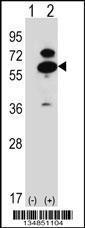 Anti-OXSR1 Rabbit Polyclonal Antibody (AP (Alkaline Phosphatase))