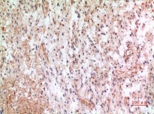 Immunohistochemical analysis of paraffin-embedded human brain using Anti-CX3CL1 Antibody