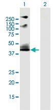 Anti-ADRB2 Mouse Polyclonal Antibody