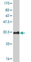 Anti-HES2 Mouse Monoclonal Antibody [clone: 3H1]