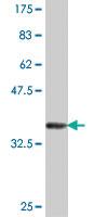 Anti-ALAD Mouse Polyclonal Antibody