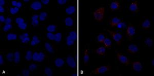 Immunocytochemistry/Immunofluorescence analysis of human A549 cells, using Anti-VPS35 Antibody [10A8] (A305035), at 1:5 (tissue culture supernatant)