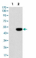 Anti-IL1B Mouse Monoclonal Antibody [clone: 3A6]