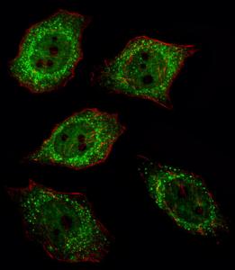 Anti-UCHL1 Rabbit Polyclonal Antibody (HRP (Horseradish Peroxidase))