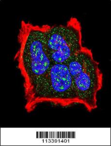 Anti-TSC2 Rabbit Polyclonal Antibody (AP (Alkaline Phosphatase))