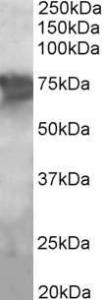 Anti-PCK2 Antibody (A83245) (2 µg/ml) staining of Human Liver lysate (35 µg protein in RIPA buffer). Primary incubation was 1 hour. Detected by chemiluminescence