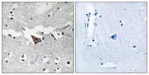 Immunohistochemical analysis of paraffin-embedded human brain tissue using Anti-FAK Antibody. The right hand panel represents a negative control, where the antibody was pre-incubated with the immunising peptide