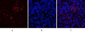 Anti-CD81 antibody