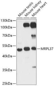 Anti-MRPL37 antibody