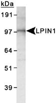 Anti-LPIN1 Rabbit Polyclonal Antibody