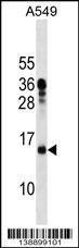 Anti-MRPL11 Rabbit Polyclonal Antibody (AP (Alkaline Phosphatase))