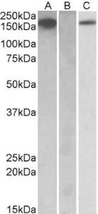 HEK293 lysate (10ug protein in RIPA buffer) overexpressing Human CSF1R with C-terminal MYC tag probed with Anti-CSF1R Antibody (A84858) (1µg/ml) in Lane A and probed with anti-MYC Tag (1/1000) in lane C