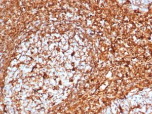 Antibody anti-cytokeratin 8 K88 100 µg