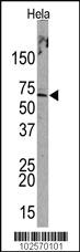 Anti-PML Rabbit Polyclonal Antibody