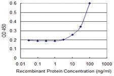 Anti-FBXO27 Mouse Monoclonal Antibody [clone: 1G6]