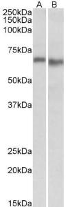 Anti-PRKAA2 Antibody (A84859) (0.3 µg/ml) staining of Mouse (A) and Rat (B) Heart lysate (35 µg protein in RIPA buffer). Primary incubation was 1 hour. Detected by chemilu minescence