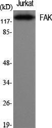 Western blot analysis of various cells using Anti-FAK Antibody