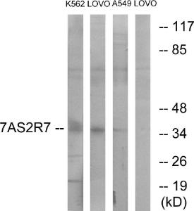 Antibody anti-TAS2R7 A99504-100 100 µg