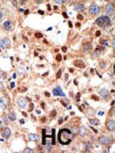 Anti-PML Rabbit Polyclonal Antibody