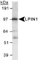 Anti-LPIN1 Rabbit Polyclonal Antibody