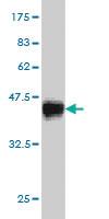 Anti-CDK8 Mouse Monoclonal Antibody [clone: 6E5]