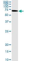 Anti-CK83 Polyclonal Antibody Pair