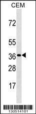 Anti-OR3A3 Rabbit Polyclonal Antibody (PE (Phycoerythrin))