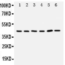 Anti-TRAM1 Rabbit Polyclonal Antibody