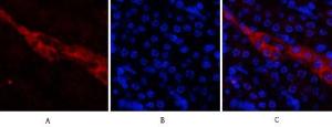 Anti-CD81 antibody