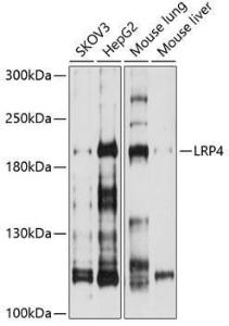 Western blot analysis of extracts of various cell lines, using Anti-LRP4 Antibody (A8542) at 1:1,000 dilution. The secondary antibody was Goat Anti-Rabbit IgG H&L Antibody (HRP) at 1:10,000 dilution. Lysates/proteins were present at 25µg per lane.