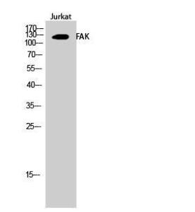 Western blot analysis of Jurkat cells using Anti-FAK Antibody