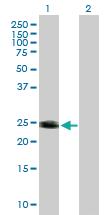 Anti-HRAS Mouse Polyclonal Antibody