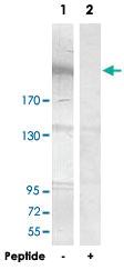 Anti-ZNF638 Rabbit Polyclonal Antibody