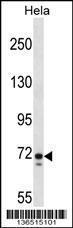 Anti-GALNT6 Rabbit Polyclonal Antibody (HRP (Horseradish Peroxidase))