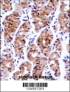 Anti-GTF2E1 Rabbit Polyclonal Antibody