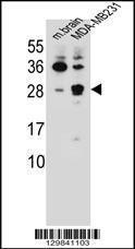 Anti-CBLN2 Rabbit Polyclonal Antibody