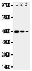 Anti-TRAM2 Rabbit Polyclonal Antibody