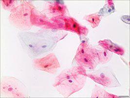 Papanicolaou stain, modified ea