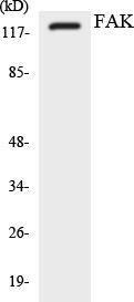 Western blot analysis of the lysates from K562 cells using Anti-FAK Antibody
