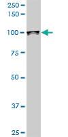 Anti-UBTF Mouse Monoclonal Antibody [clone: 1A2]