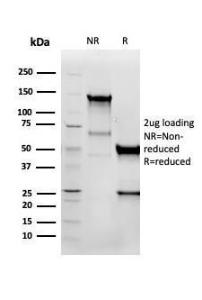 Antibody anti-cytokeratin 8 K88 100 µg